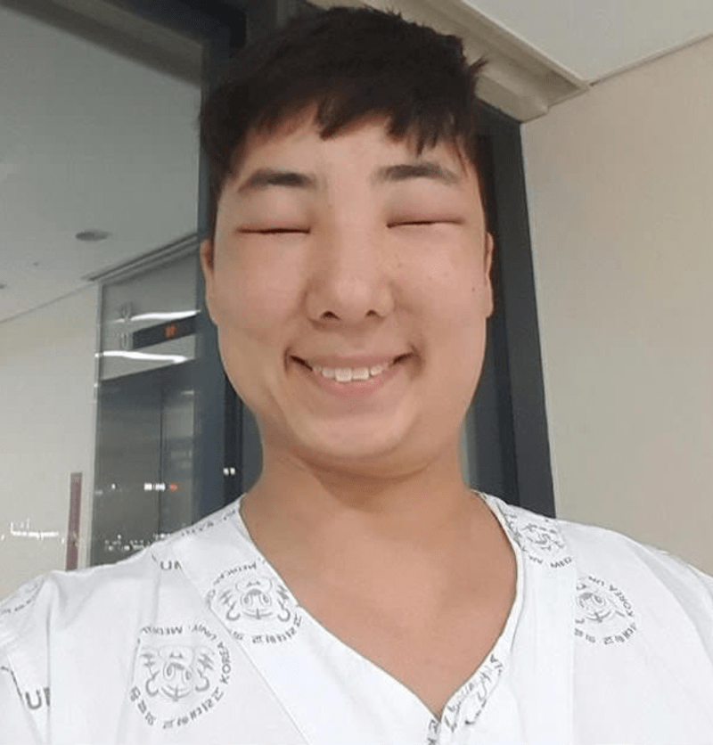 Korejec dostal alergickou reakci na barvu na vlasy - Obrázek 12