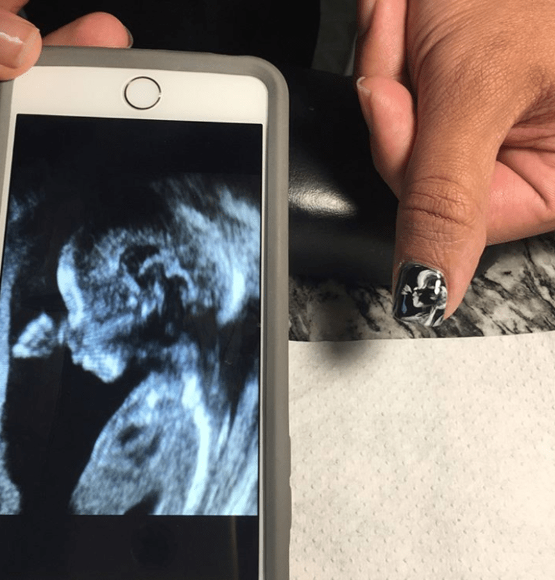 Ženy si nechávají na nehty malovat své snímky z ultrazvuku 2