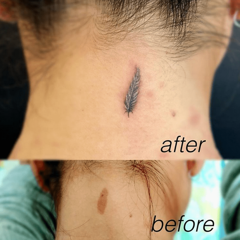 Tetování, která dokonale zakrývají vady kůže 2