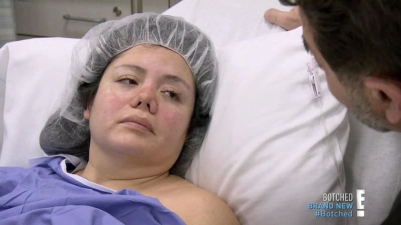 Žena se po liposukci probudila i s plastikou nosu 4