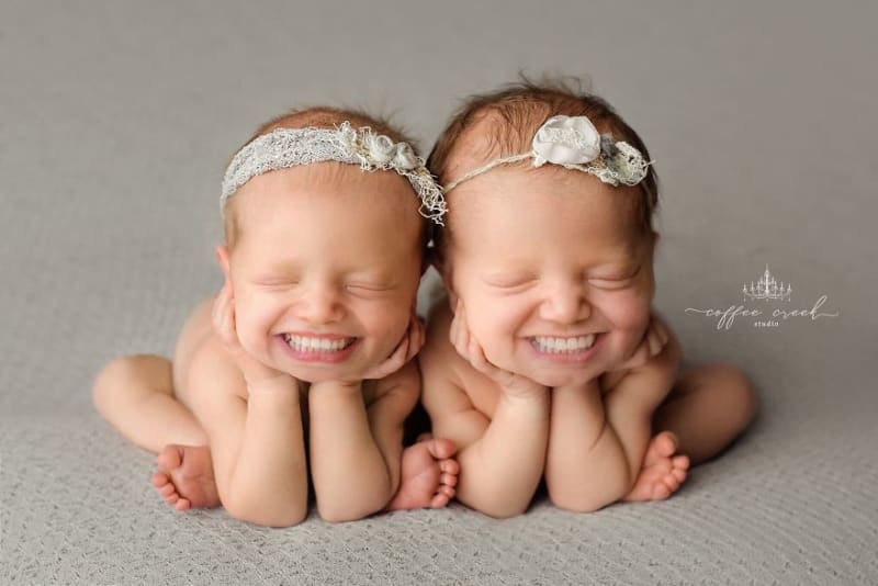 Fotky novorozenců se zuby děsí celý internet 7