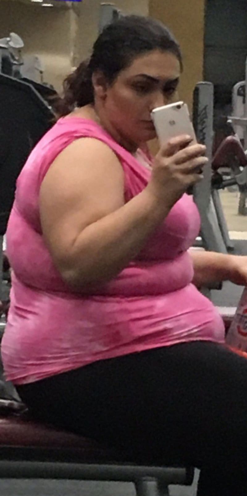 Žena zhubla po zmenšení žaludku 3