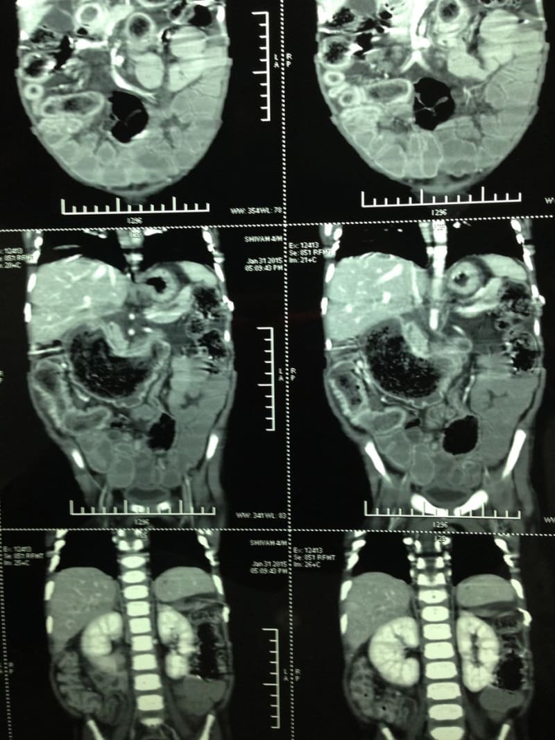Snímky z CT ukázaly v čem je problém