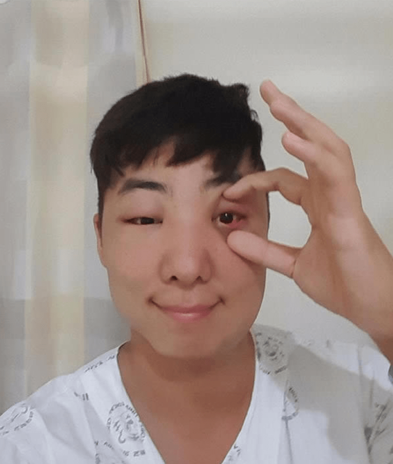 Korejec dostal alergickou reakci na barvu na vlasy - Obrázek 11