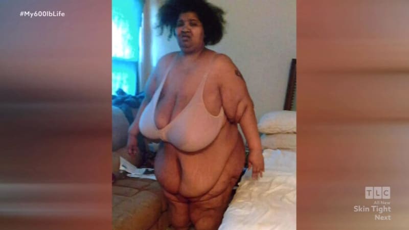 Morbidně obézní žena vydělávala přejídáním se 9