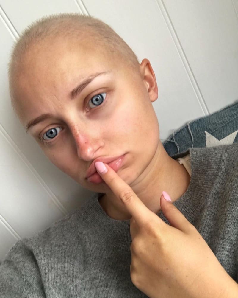 Olivia Smith - rakovina 2