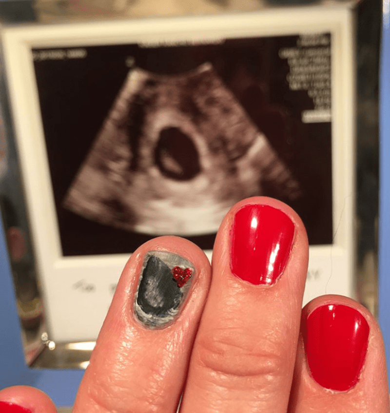 Ženy si nechávají na nehty malovat své snímky z ultrazvuku 4