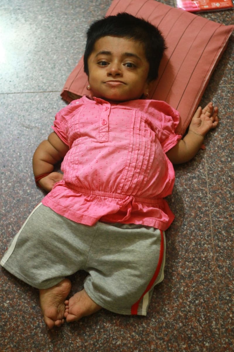 Dívka uvězněná v těle dvouletého dítěte