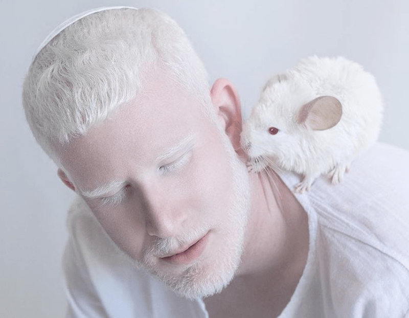 Krása lidí s albinismem 13