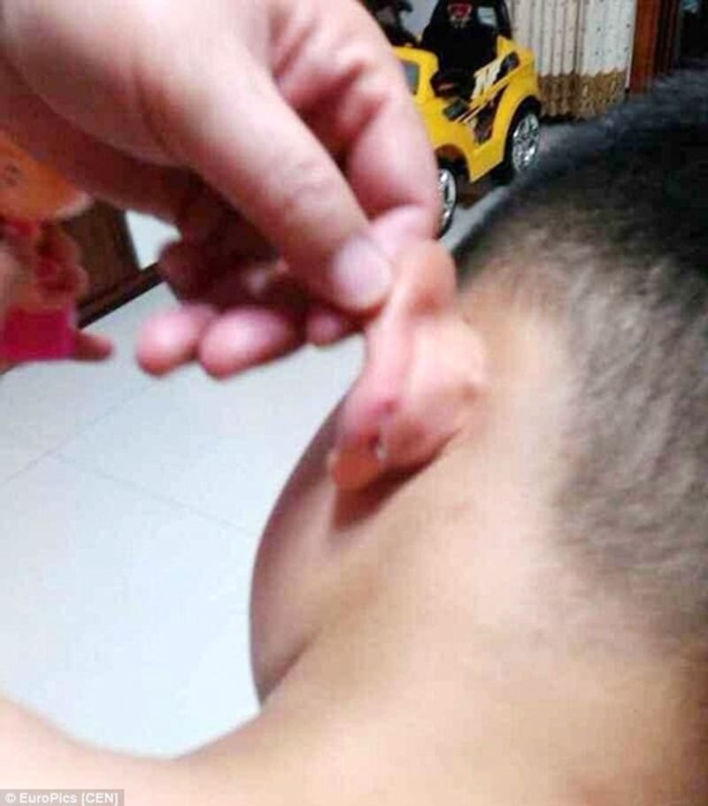 Chlapec se vrátil ze školky a měl v uchu sponku ze sešívačky - Obrázek 2
