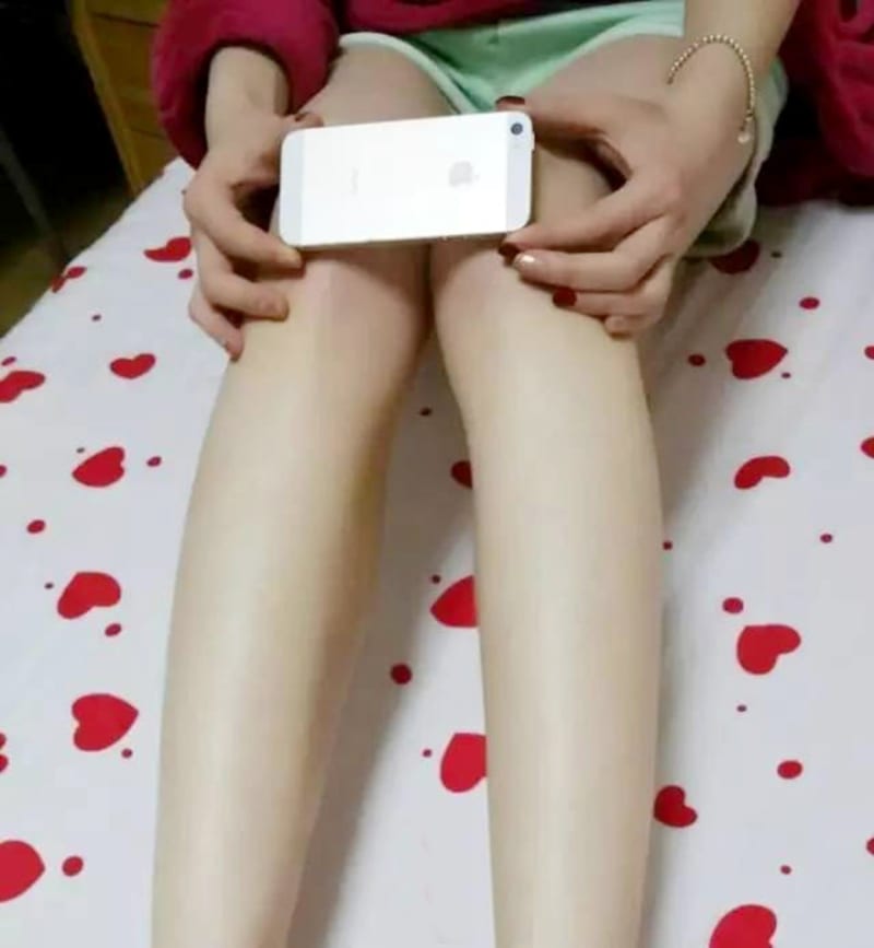 iPhone knees v plné paráda - Obrázek 2