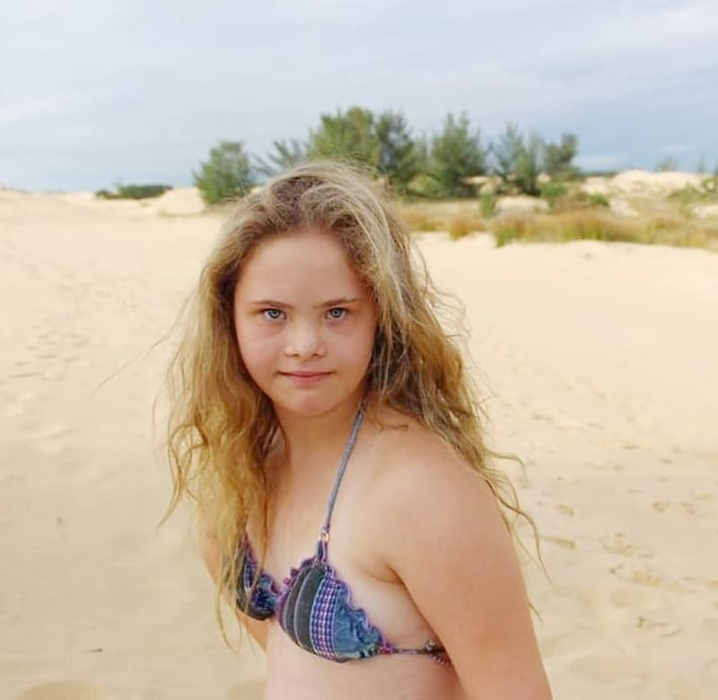 Modelka s Downovým syndromem je hvězdou Instagramu 7