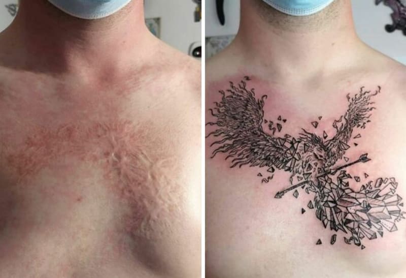 Tetování, které lidem vrátilo sebevědomí 3