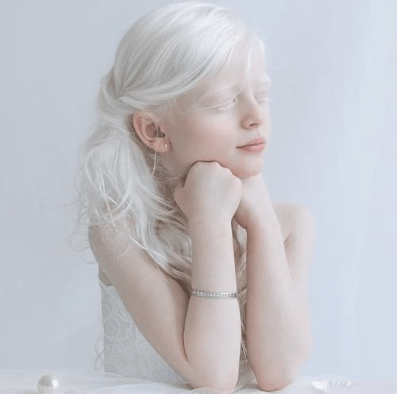 Krása lidí s albinismem 3