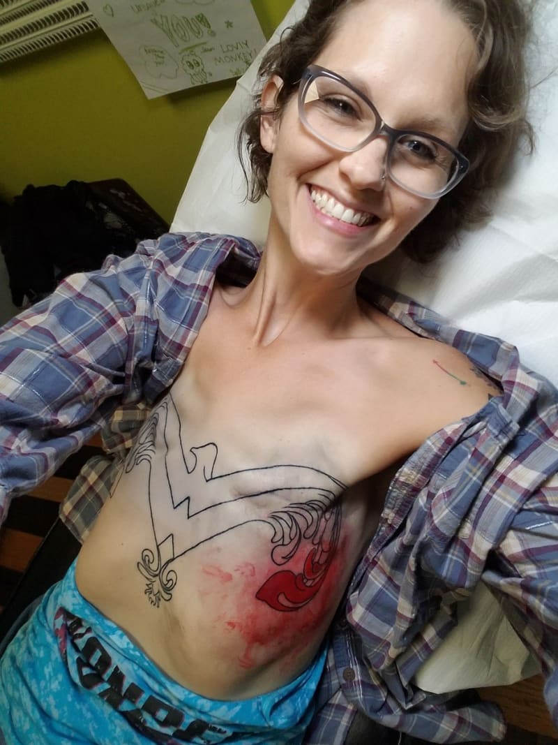 Žena si nechala odstranit prsa kvůli strachu ze vzniku rakoviny - Obrázek 4