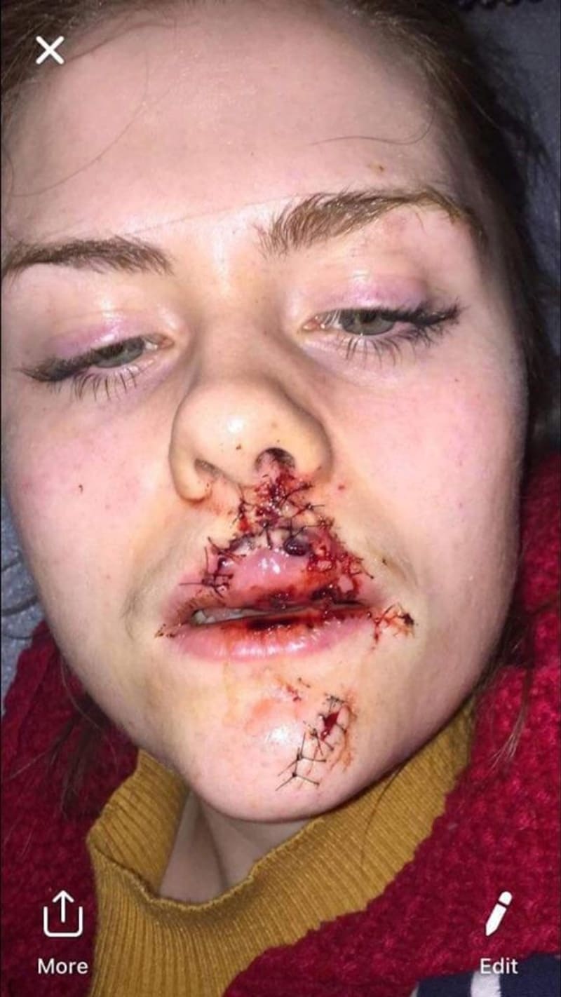 Útočníci napadli ženu a vyrazili jí zuby 3