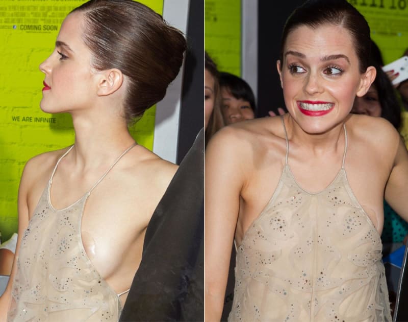 I celebrity mají občas problém s oblečením - Emma Watson neuhlídala bradavky
