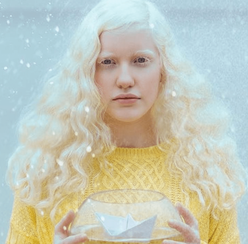 Krása lidí s albinismem 14
