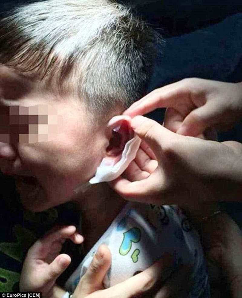 Chlapec se vrátil ze školky a měl v uchu sponku ze sešívačky - Obrázek 3