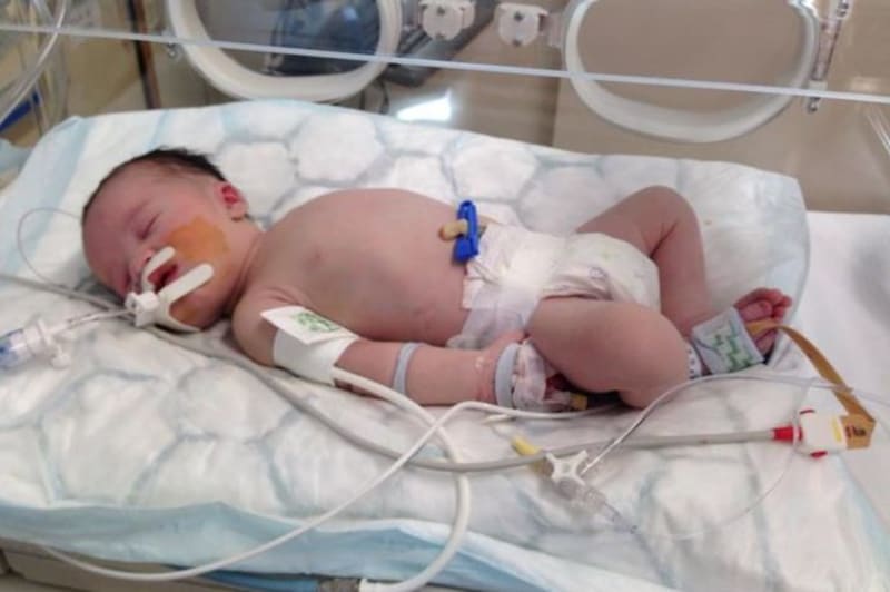 Chlapeček zemřel tři dny po porodu