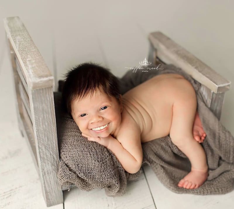 Fotky novorozenců se zuby děsí celý internet 9