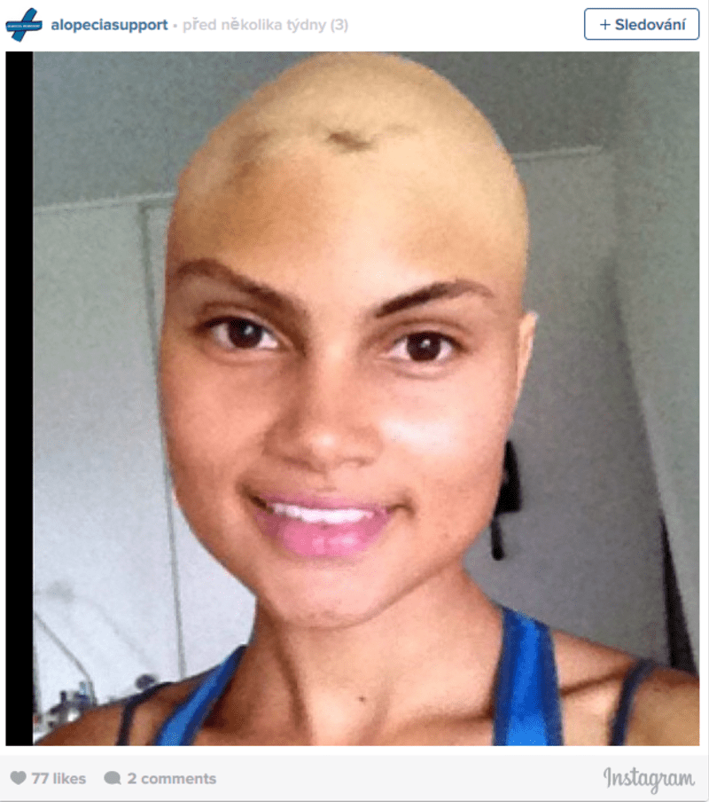 Krásné a silné ženy, se snaží podpořit ostatní v nelehkém boji s rakovinou - Obrázek 7
