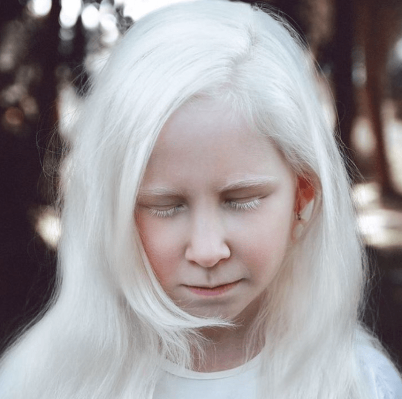 Krása lidí s albinismem 16