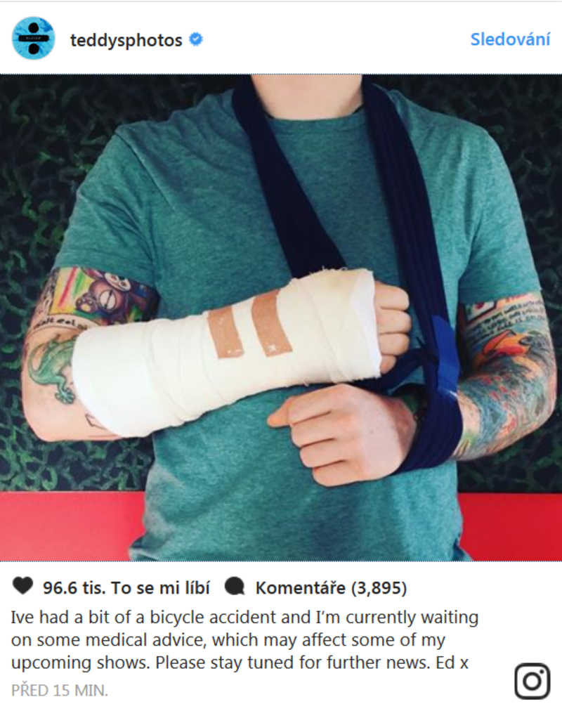 Ed Sheeran si při nehodě zlomil ruku.