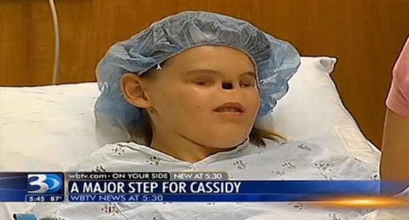 Cassidy před náročným zákrokem.