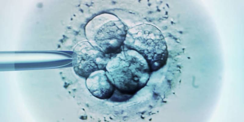 IVF - umělé oplodnění