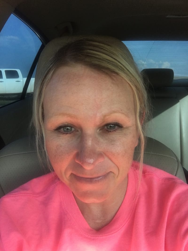Žena s dírou v nose po rakovině kůže 5