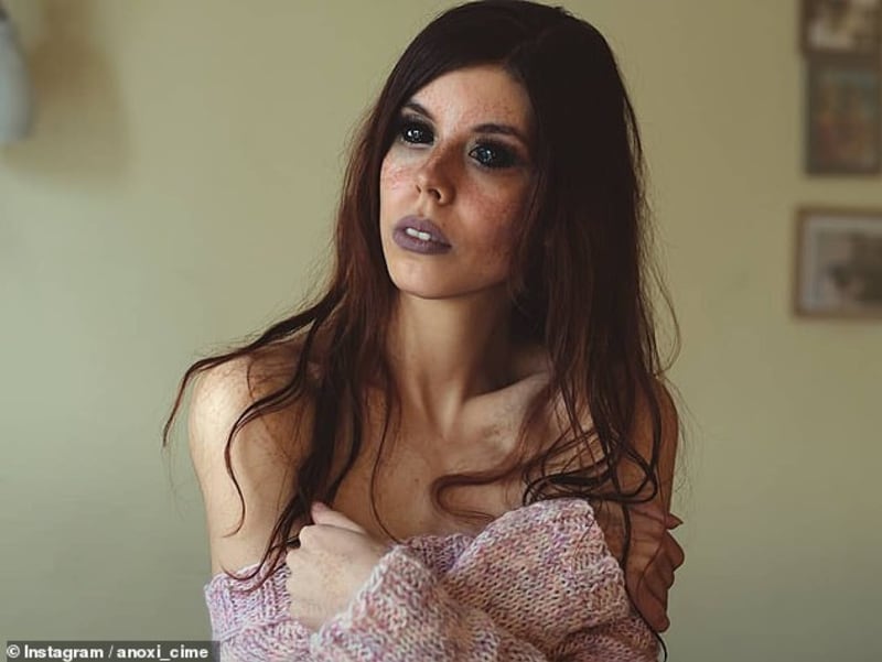 Sexy modelka ztratila zrak poté, co si nechala potetovat oční bulvy.