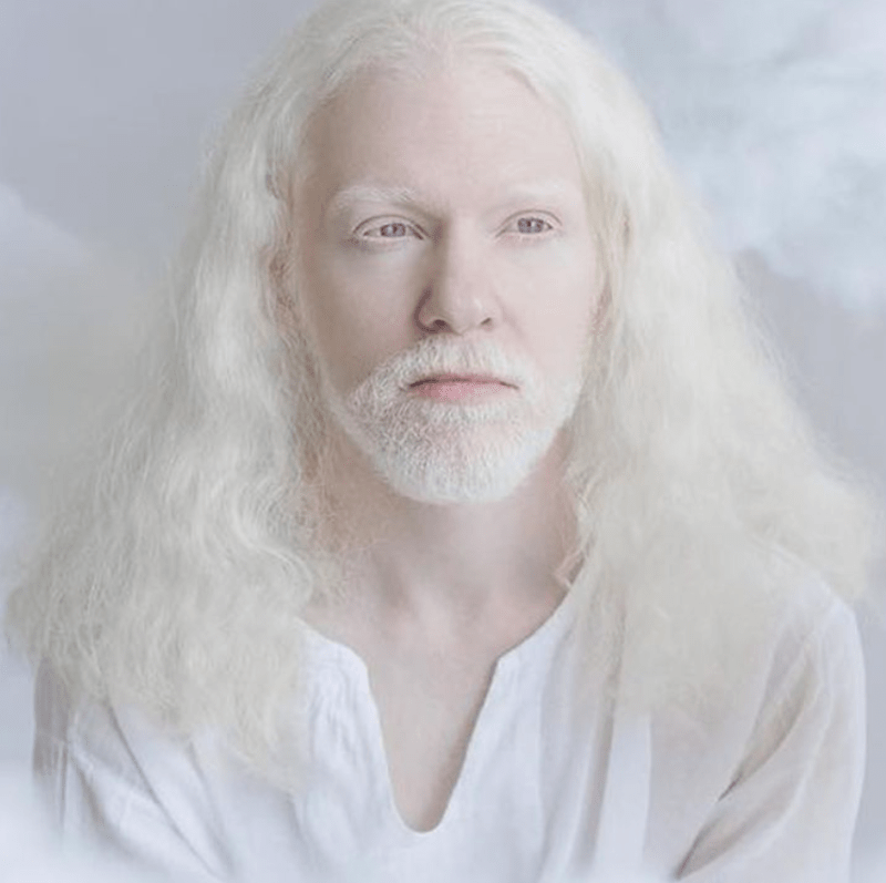 Krása lidí s albinismem 11