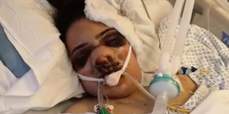 Žena upadla při plastické operaci do kómatu 3