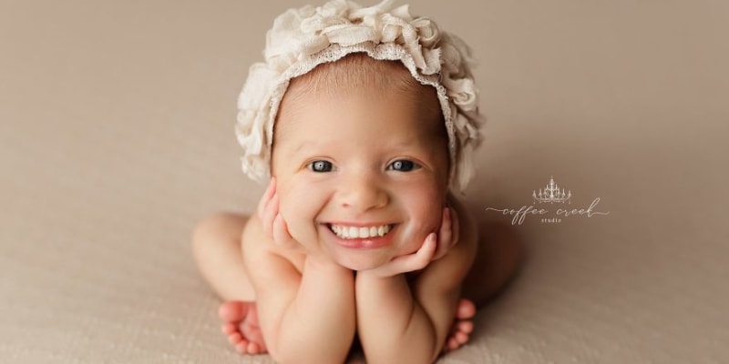 Fotky novorozenců se zuby děsí celý internet 5