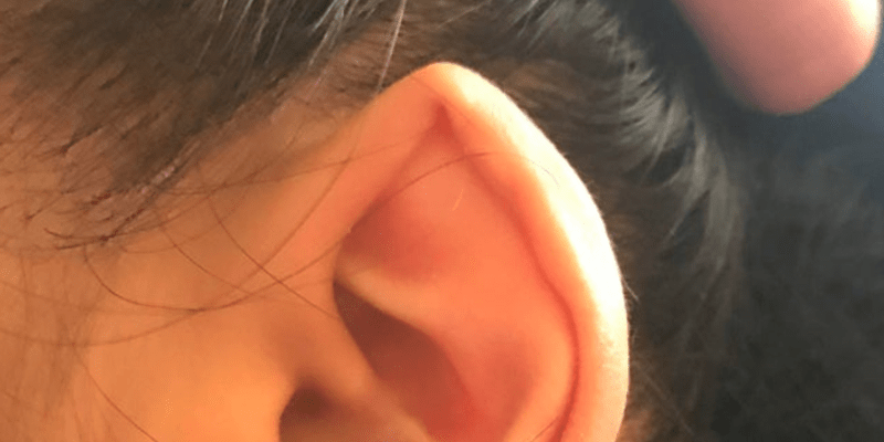 Elfí uši