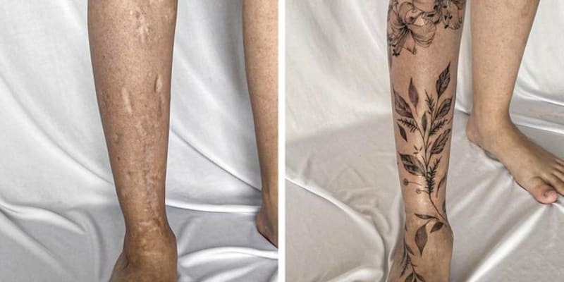 Tetování, které zakrylo jizvy 6