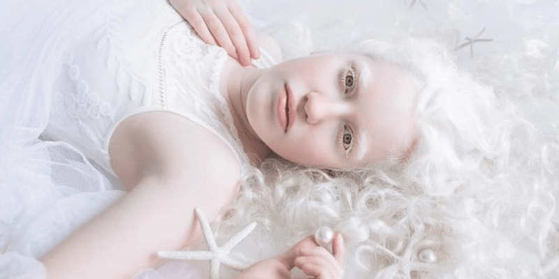 Krása lidí s albinismem 1