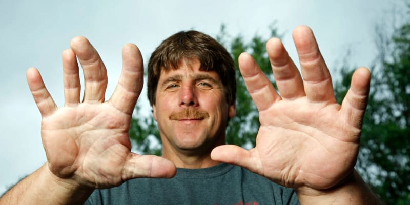Jeff Bade se narodil s gigantickými dlaněmi a pažemi