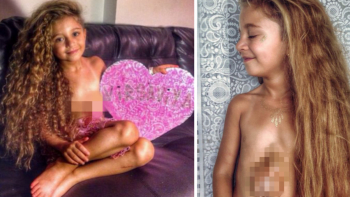 FOTO: 6letá holčička má srdce venku! Můžete vidět, jak jí bije srdce