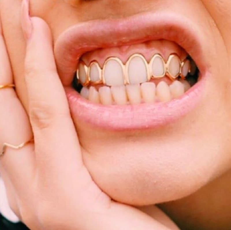 Šílené zlaté zuby - Obrázek 6