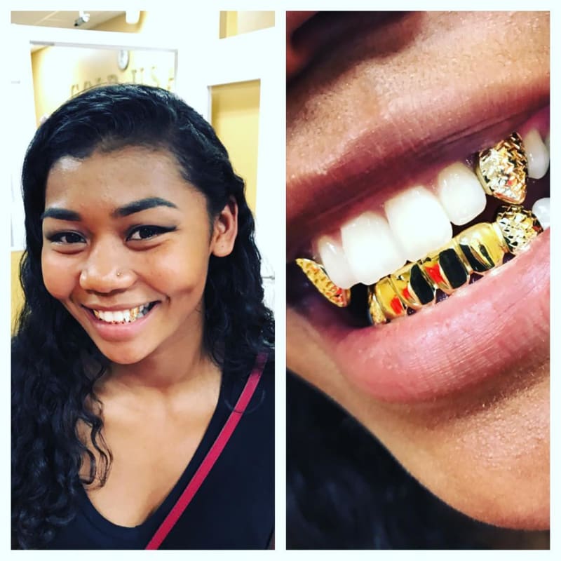 Šílené zlaté zuby - Obrázek 2
