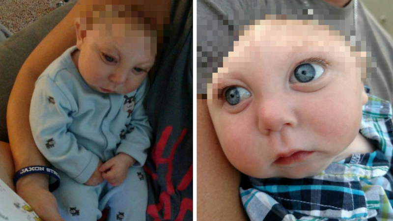 FOTO: Od narození má zdeformovanou lebku, ale daří se mu skvěle! Lékaře překvapuje tím, co umí…