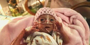 Zázrak v olomoucké nemocnici: Lékaři zachránili Vanesku, po porodu vážila jen 395 gramů