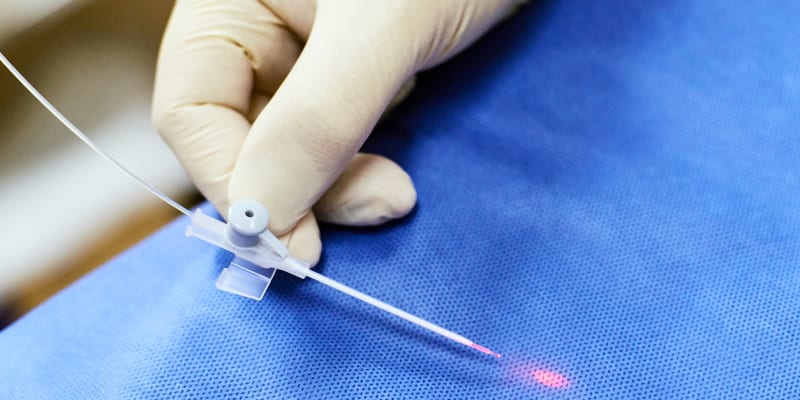 Miniinvazivní odstranění křečových žil, například laserem, je čím dál více oblíbené.