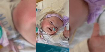 CNN: Medicínský zázrak. Holčička se narodila s orgány mimo tělo, žije a nepřestává se usmívat