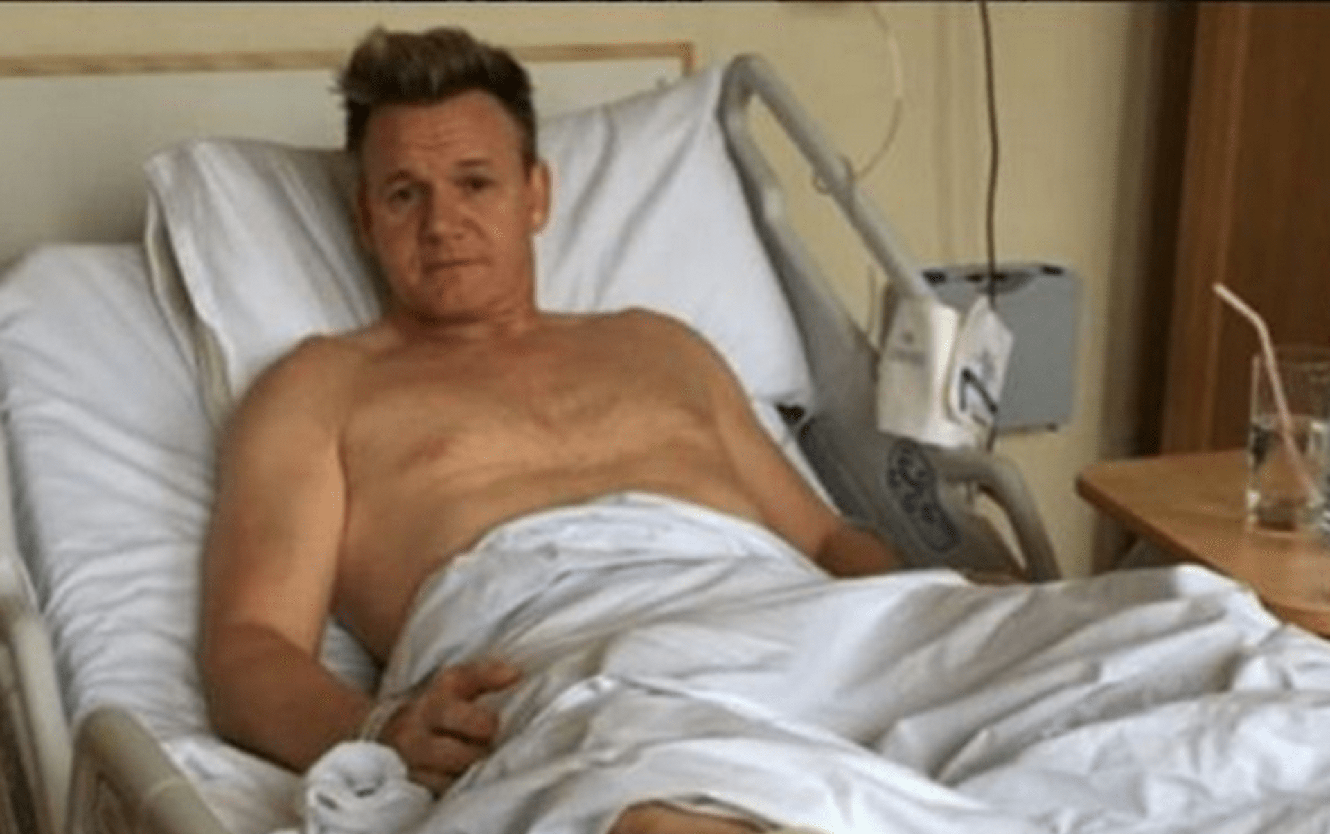 Gordon Ramsey skončil v nemocnici kvůli achilovce