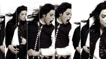 Nejšílenější úchylky: Michael Jackson nebyl jediný s obsesí bělení kůže