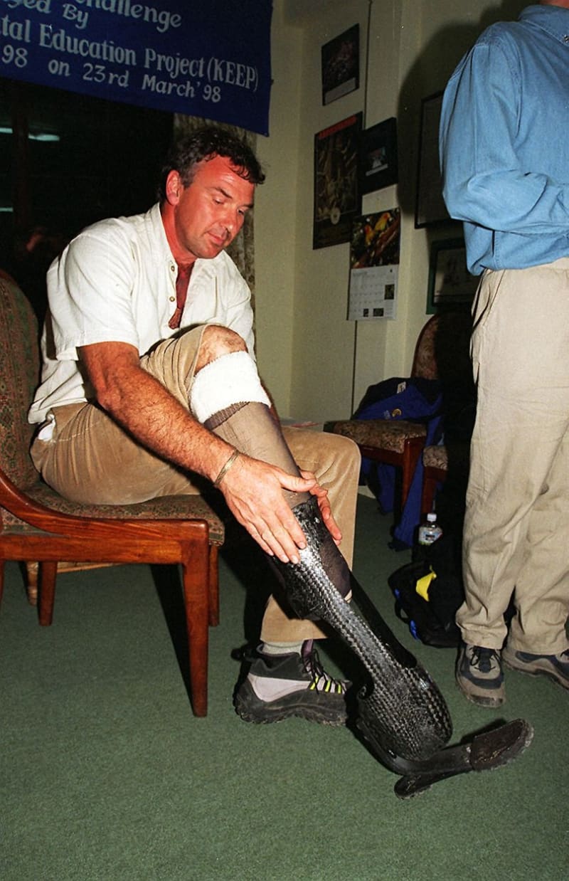 Tom Whittaker nasazuje speciální protézu, se kterou vyšplhal na Everest