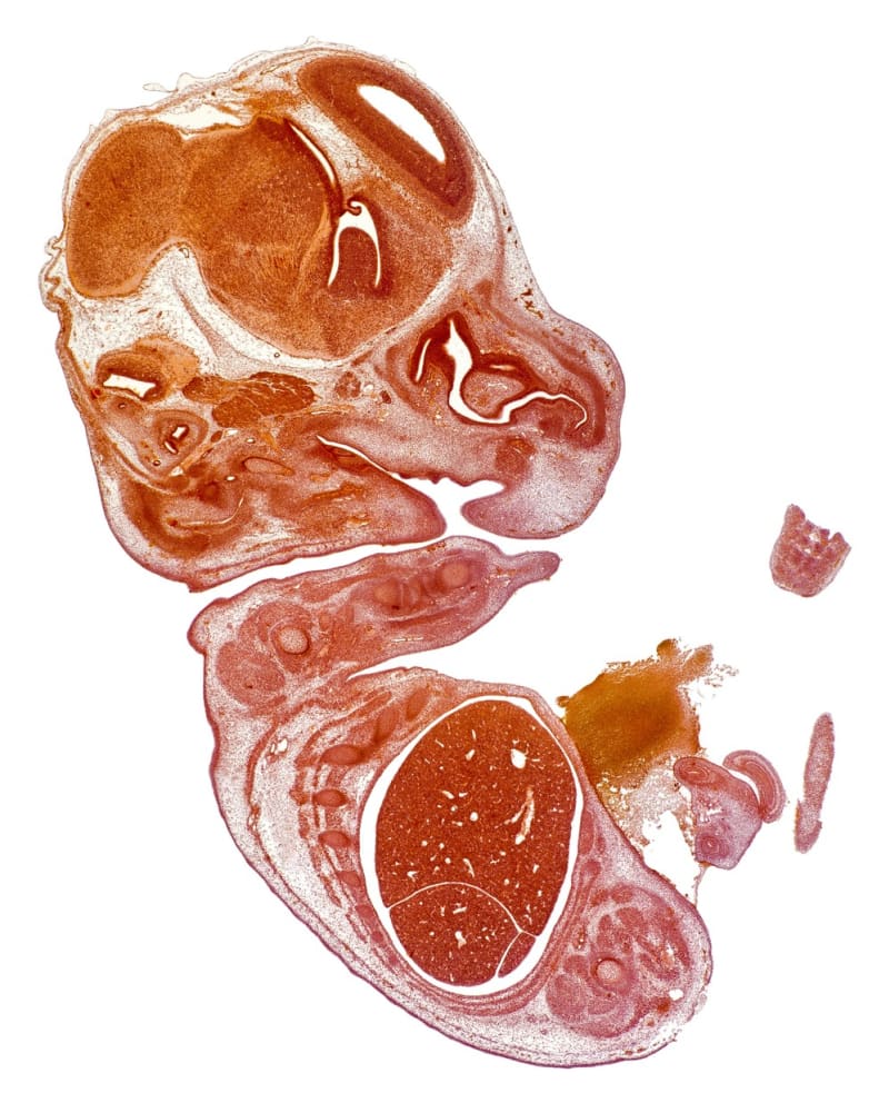 Myší embryo staré 14 dnů